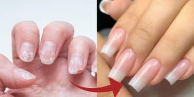 Antes e depois da unha em gel caseira (Foto: Reprodução/ Internet)