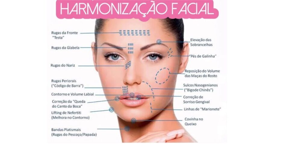 Apesar de famigerada, uma harmonização pode ser bem cara (Foto Reprodução/Florida Estética)