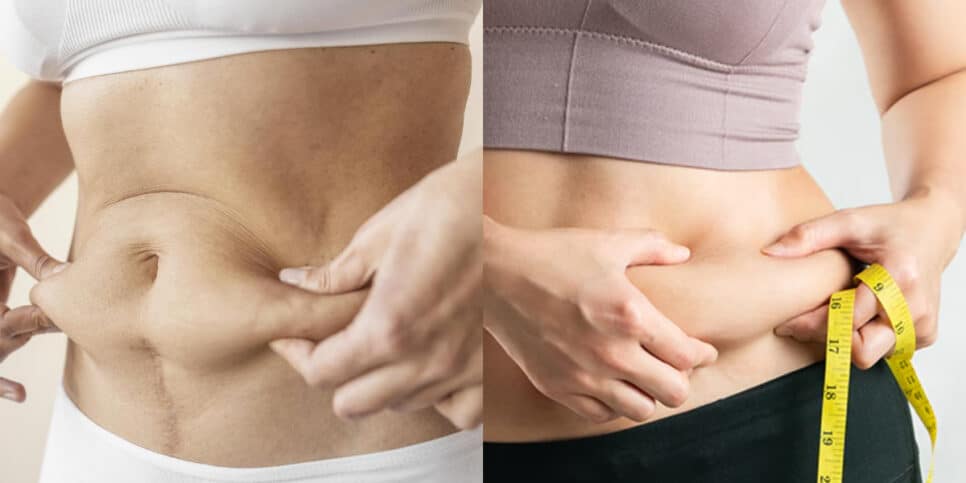 Único ingrediente te ajuda a resolver pesadelo de gordura abdominal (Foto: Montagem)