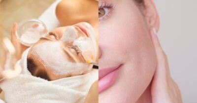 Harmonização facial caseira com 2 ingredientes - Foto: Internet