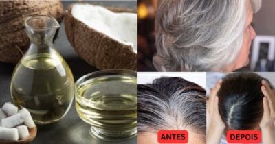 3 óleos caseiros cobrem 100% do cabelo branco - Foto: Montagem