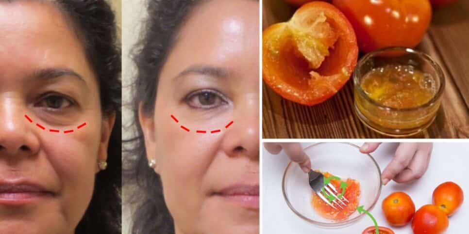 Resultado da aplicação de tomates amassados nas olheiras (Foto Reprodução/Montagem/Pinterest)